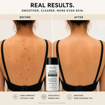 Bellam Body Stick